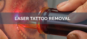 Laser Removal Surgery