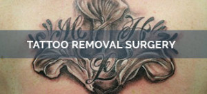 Tattoo Removal Surgery