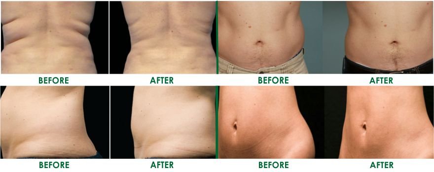Vitiligo Treatment Delhi India, Vitiligo Treatment Clinic Delhi